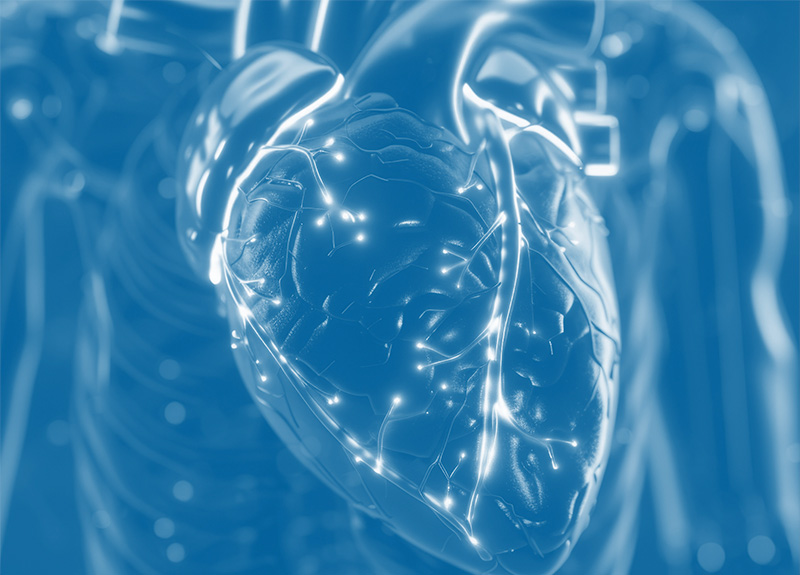 HYPERTROPHIC CARDIOMYOPATHY (HCM)